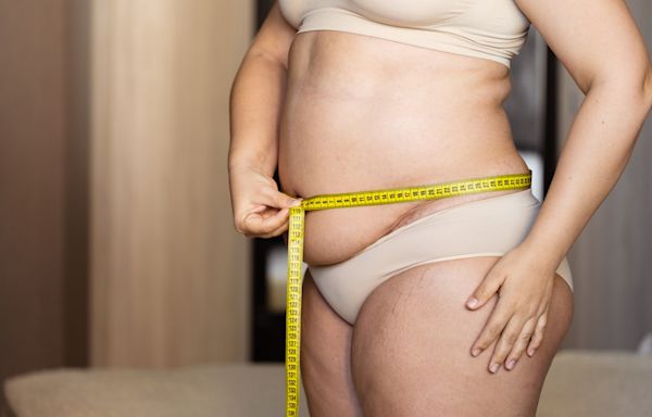 Obesity threshold should be LOWERED - as millions at risk of killers are missed