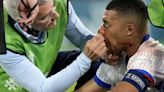 Kylian Mbappé's nose injury places doubt on his continued involvement in Euro 2024