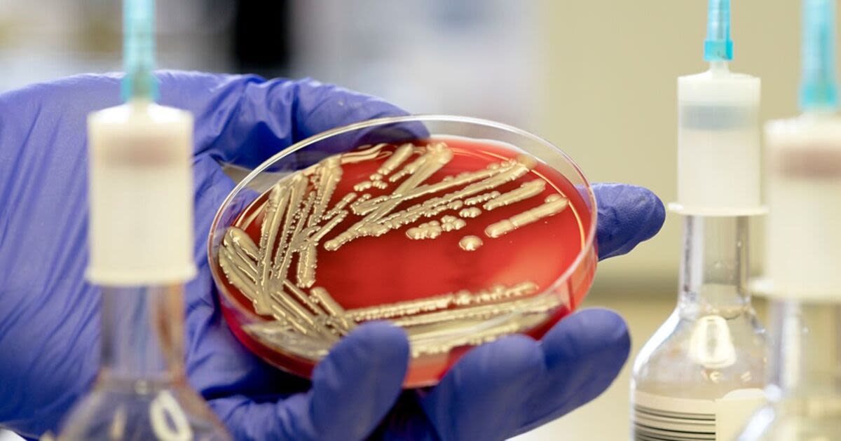 Search for mystery 'nationally distributed food item' that spread E.coli to 113