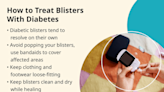 Diabetic Blisters: A Symptom of Mismanaged Diabetes?