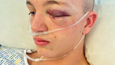 Boy left in coma after thugs knocked him unconscious at TRNSMT