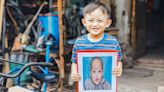 People with cleft lip and palate have life-changing opportunities. Support them | Opinion