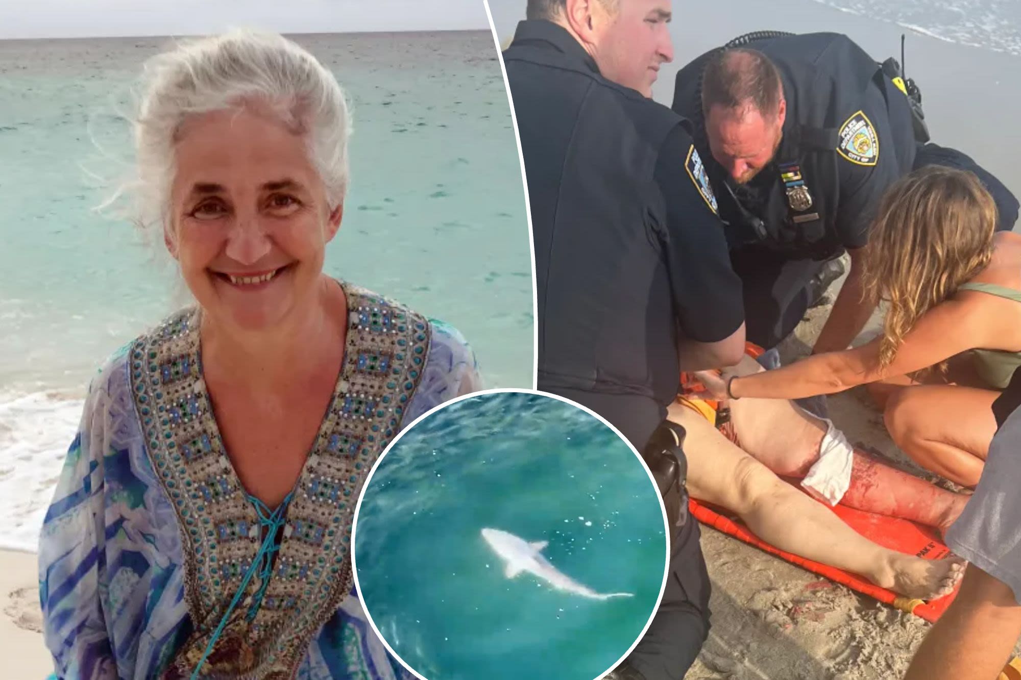 Rockaway shark bite victim on long road to recovery — as NYC beach season opens