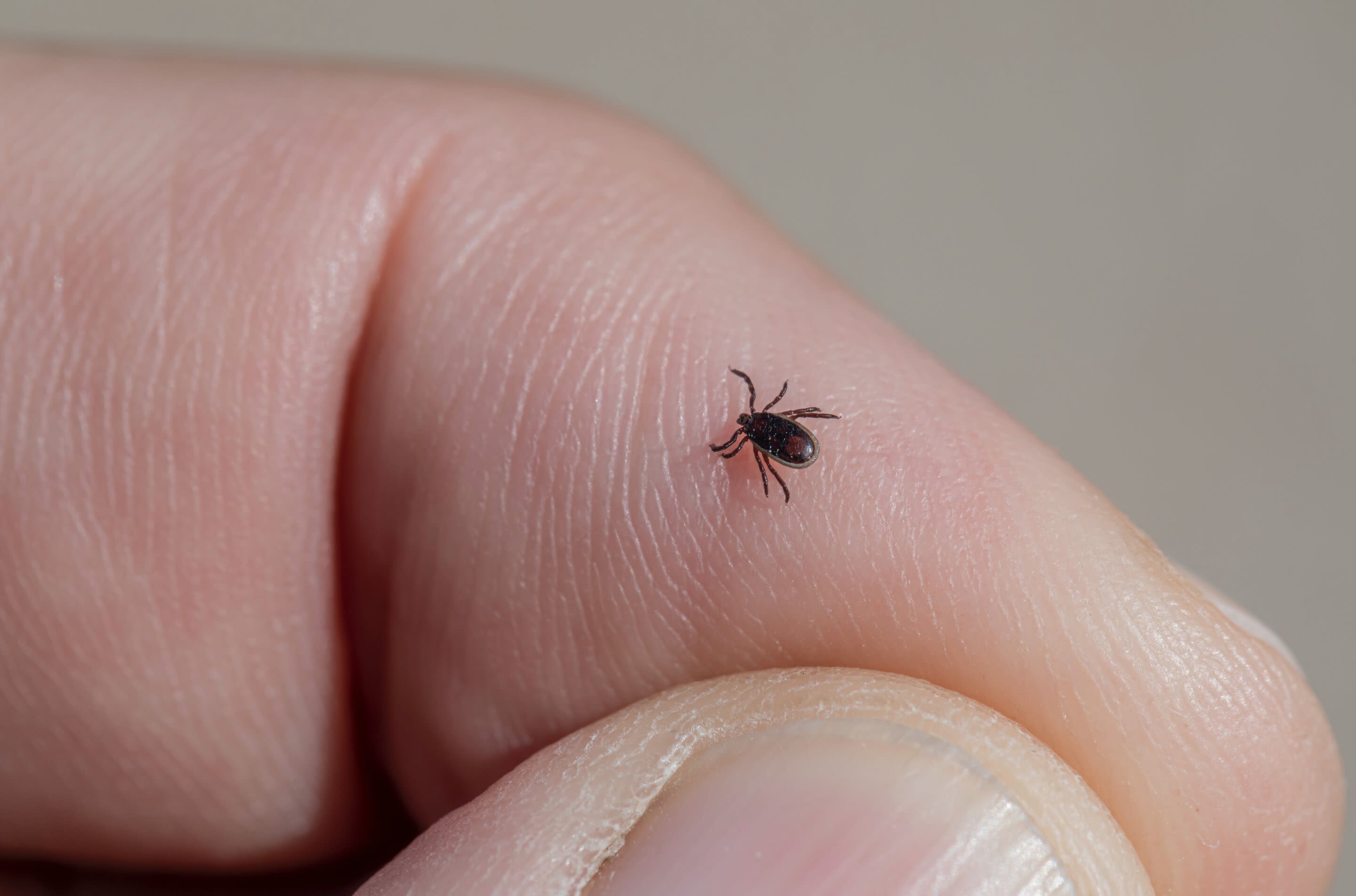 Tick-borne Powassan virus reported in Massachusetts
