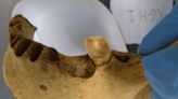 Ancient teeth rarely have a cavity-causing bacteria commonly seen today. A new study reveals why