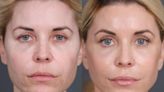 McKenzie Westmore Shares Facelift Transformation Photos Following Painful Journey with Fillers