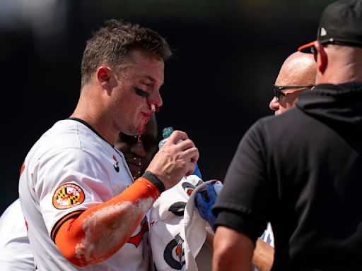 Orioles' James McCann stays in game after taking fastball to his face