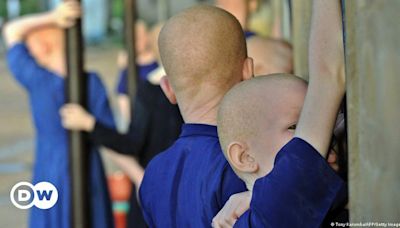 Albinos em Angola continuam a ser discriminados – DW – 13/06/2024