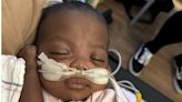 ‘Micropreemie’ who weighed just over 1 pound at birth goes home from hospital
