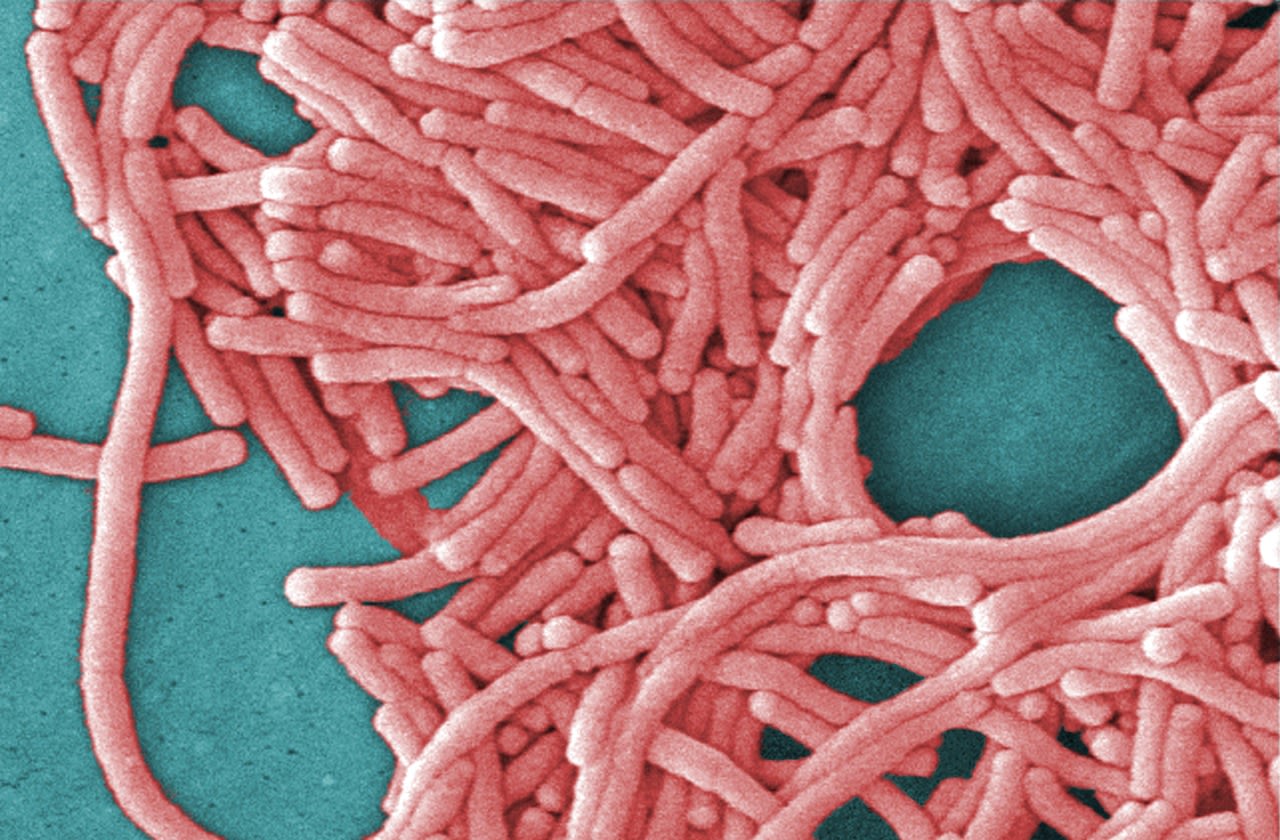 Legionnaire’s disease outbreak has killed 3 at NY assisted living facility