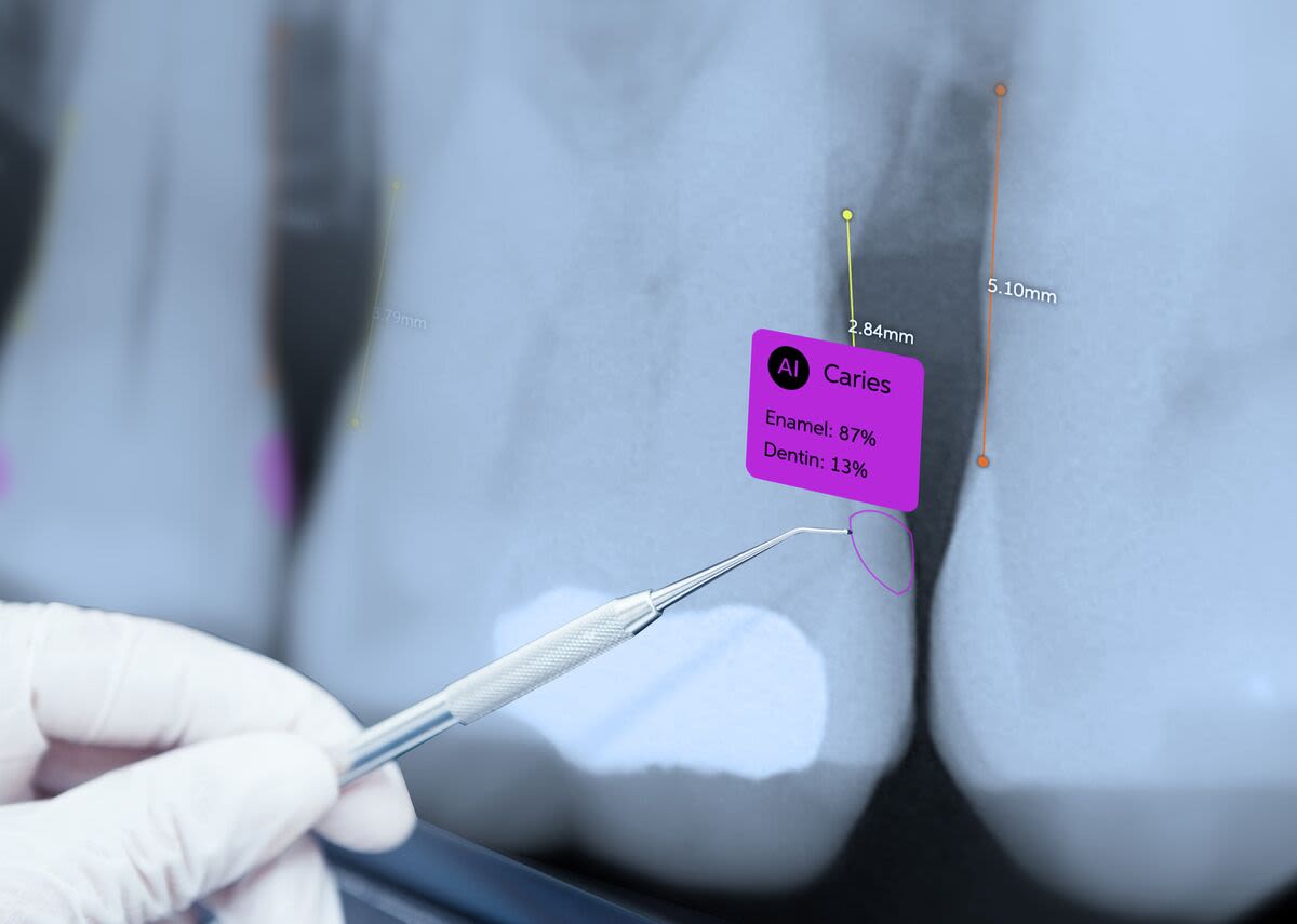 Startup Pearl Raises VC Funding to Bring AI to Dentists’ Offices