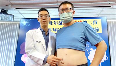 愛吃油炸 39歲男血便罹直腸癌 - 自由健康網