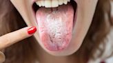 Doctor Shares What Your Tongue’s Appearance Reveals About Health Issues