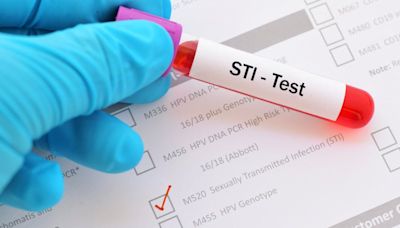 Sherlock starts clinical trial for rapid OTC diagnostics for STIs