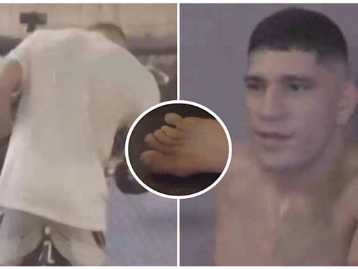 Alex Pereira shares footage of him breaking his toe just TWO weeks before UFC 300 fight