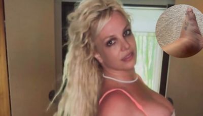 Britney Spears muestra VIDEO de su tobillo lastimado y arremete contra su mamá: "¡No la soporto!"