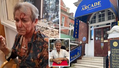 Celebrity antiques dealer shares update after being 'smashed to bits' by hammer-wielding thugs during £100,000 raid