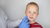 When do kids need to see a dermatologist? Here's what experts say.
