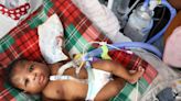 Steep cost of long-term preemie care takes heavy toll on overburdened families
