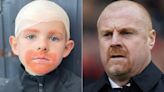 Boy, 5, comes to school fancy dress day as Sean Dyche