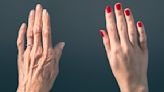 How to Make Hands Look Younger — Dermatologists' Best At-Home Tricks
