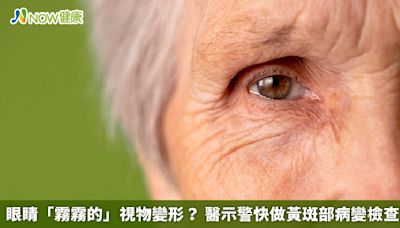 眼睛「霧霧的」視物變形？ 醫示警快做黃斑部病變檢查 | 蕃新聞