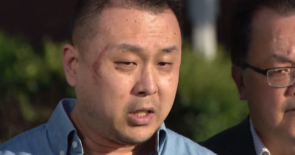 Vet brutally attacked outside grocery store in Chicago's South Loop, believes it was hate crime