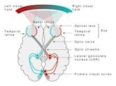 Visual system