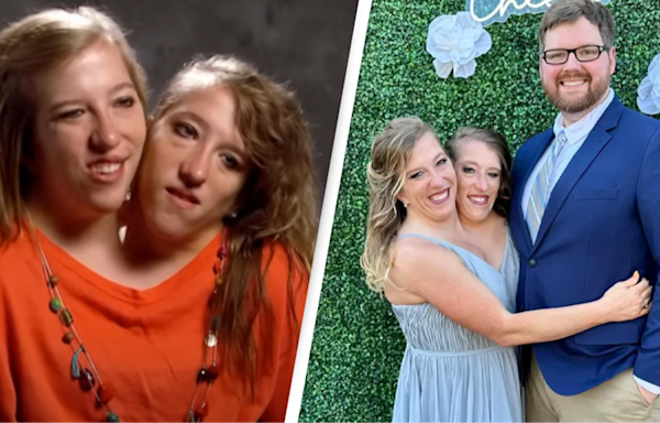 Conjoined twins Abby and Brittany Hensel answer all the questions everyone regularly asks them