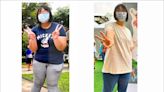140公斤女 「胃夾微創手術」減重60公斤 - 自由健康網