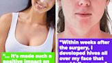 People Who Have Had Plastic Surgery Are Sharing Their Stories, And The Comments Will Totally Change Your Perspective On...