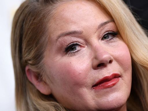 Christina Applegate Reveals ‘The Only Plastic Surgery’ She’s Had, And It’s Heartbreaking