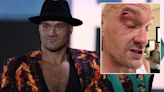 Tyson Fury 'won't mind if there's blood and guts all over ring' in Usyk fight