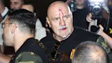 Tyson Fury’s father John cut after clash with member of Oleksandr Usyk entourage
