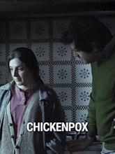 Chickenpox