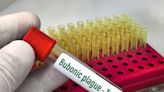 Confirman tercer caso de peste bubónica en Estados Unidos; ahora en Colorado - El Diario NY