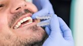 What Is The Average Cost of Braces?