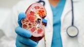 Apellis and Sobi report data from Phase II C3 glomerulopathy trial