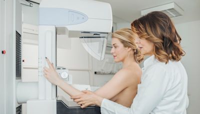 Expertos en salud recomiendan a mujeres hacerse la mamografía a partir de los 40 años - El Diario NY