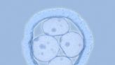 What happens to frozen embryos in a divorce? Experts say the options are complicated and outcomes can be varied.