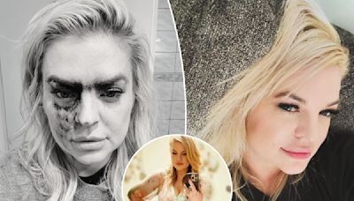 ‘General Hospital’ star Kirsten Storms shocks fans with alarming photo from freak accident