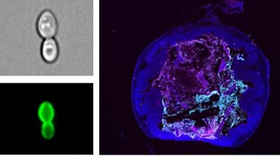 Researchers Engineer Yeast to Transport Medicines and Lower Inflammation for Potential Treatment of Inflammatory Bowel Disease | ...