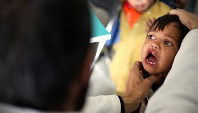 Global Smile: misión médica estadounidense operará a niños con labio leporino en Trujillo