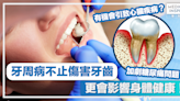 牙齒健康｜牙周病不止傷害牙齒、更會影響身體健康！