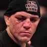 Nick Diaz