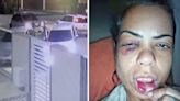 Shocking moment teacher is pulled out of car and dragged down street