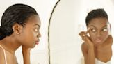 The Ultimate Acne Guide To Heal Your Skin | Essence