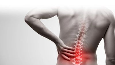 腰痛可根治！基因療法可修復椎間盤組織 - 國際