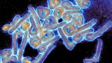 CDC warns U.S. doctors against Marburg virus after Africa outbreaks