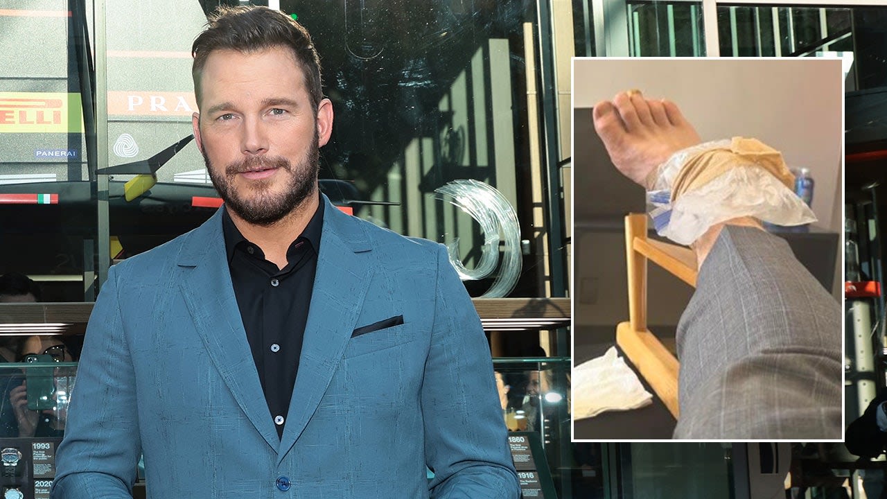 Chris Pratt suffers injury on movie set while doing his own stunts